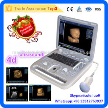 Christmas Promotion !! CU18-I New Advanced 4D ultrasound scanne/CE proved portable ultrasound scanner with 4d probe